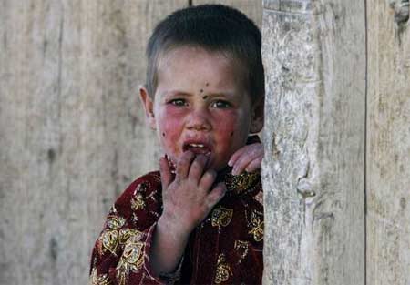 İşgal ve iç savaşın pençesindeki Afganistan'da halk, açlık ve yoksulluk içinde yaşam mücadelesi veriyor. Bu mücadelenin ortasında sıkışıp kalan en çok da çocuklar