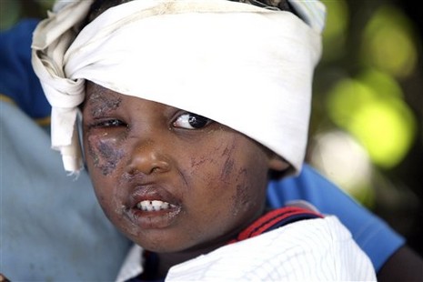 Haiti'de İnsanlar su ve gıda için savaşıyor. Cesetler ise kepçeyle toplanıyor 