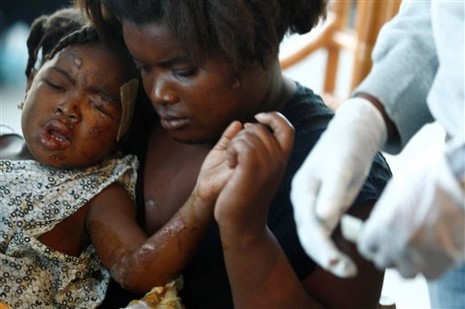 Haiti'de İnsanlar su ve gıda için savaşıyor. Cesetler ise kepçeyle toplanıyor 