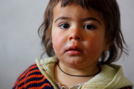 Aynı acılarla iki ayrı kent iki ayrı tutum