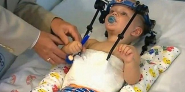 Başı kopan 16 aylık bebeğin mucize kurtuluşu!