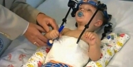 Başı kopan 16 aylık bebeğin mucize kurtuluşu!
