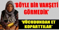 ‘Böyle bir vahşeti görmedik’