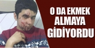 Ekmek almaya giderken gaz kapsülü ile yüzünden vuruldu