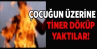 Engelli çocuğu üzerine tiner döküp yaktılar!