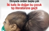 İki kafatasıyla doğdu