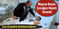 Mayına Basan Çocuğun Hayatı Karardı