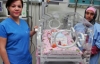 Parmak bebek yaşama tutundu