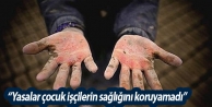 “Yasalar çocuk işçilerin sağlığını koruyamadı”
