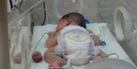 Yeni Doğan Bebek 4 Saatlik Ameliyatla Sağlığına...